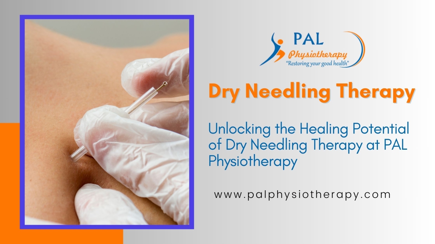 Unlocking the Healing Potential of Dry Needling Therapy at PAL Physiotherapy